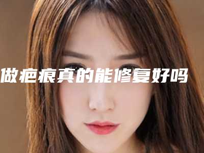 做疤痕真的能修复好吗