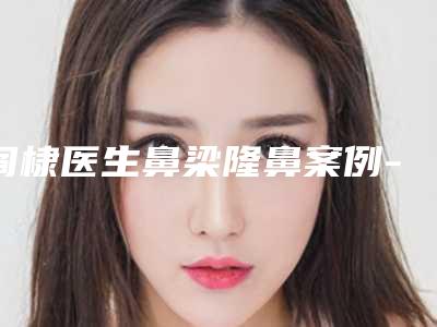 阎棣医生鼻梁隆鼻案例-价格表(费用)参考版